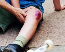 Оказание первой помощи при ушибе колена — лечение травмы в домашних условиях