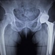 Рентген суставов ребенку: особенности и порядок проведения процедуры