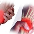 Растяжение связок кисти рук — чем грозит несвоевременное лечение болезни