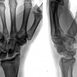 Как проявляется вывих кисти рук — эффективные методы лечения
