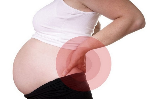 У беременных нередко диагностируют воспаление седалищного нерва