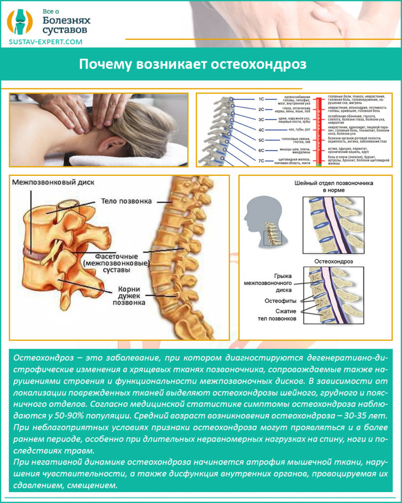 Лфк при шейном остеохондрозе упражнения в картинках