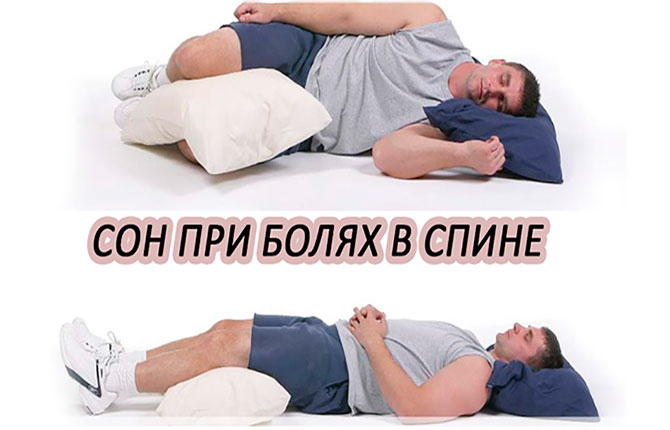 Как спать при боли в спине