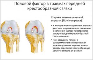 Мр картина дегенеративных изменений передней крестообразной связки