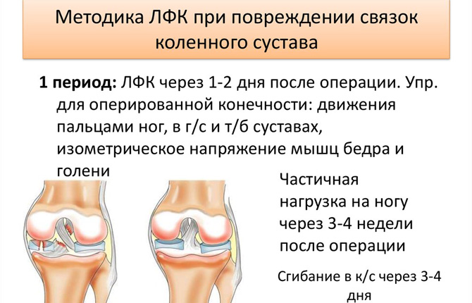 Повреждение коленной суставной капсулы. Лечебная гимнастика при разрыве связок коленного сустава комплекс. Застарелые повреждения боковых связок коленного сустава. Рубец на связке коленного сустава.