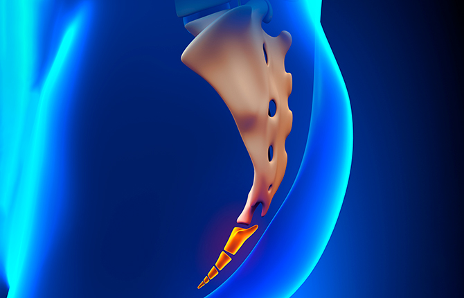 Перелом копчика симптомы. Смещение копчика инвитро.