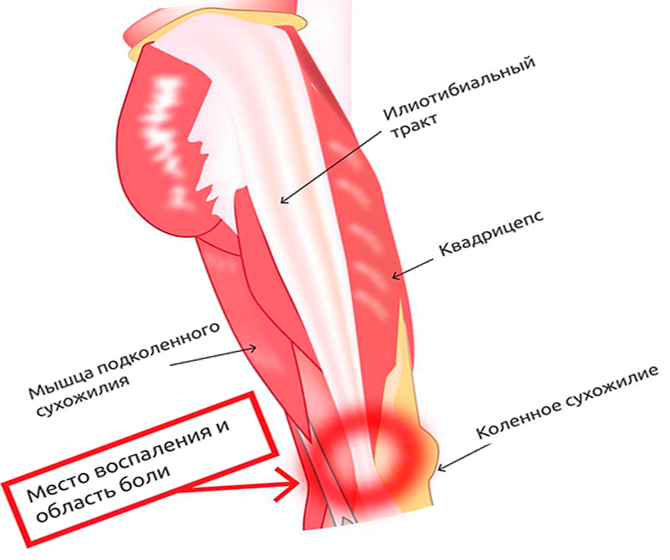 Мышцы ноги и воспаление в области колена