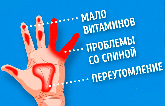 Факторы парестезии пальцев